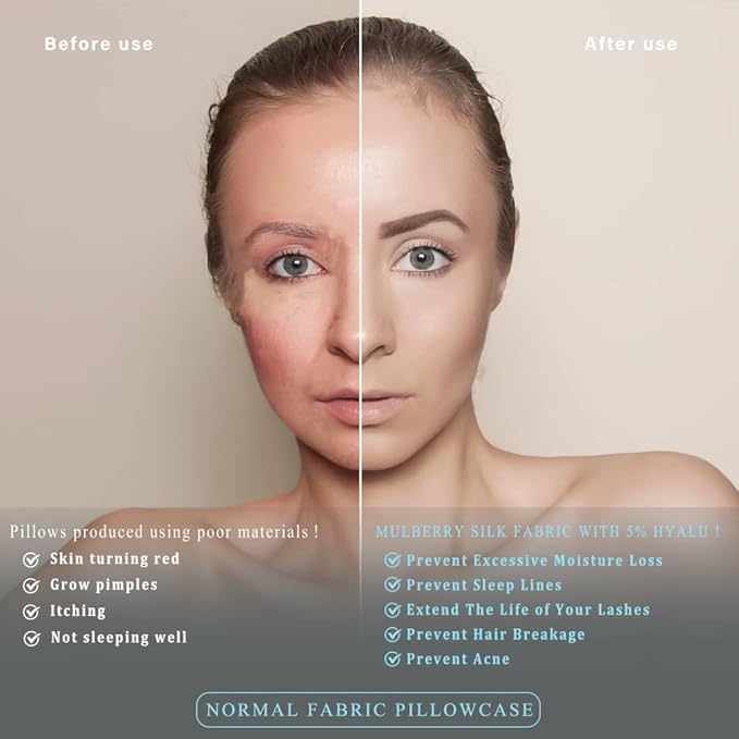 100% Mulberry Silk Pillowcases with Zipper– Luxurious, Anti-Aging Pillow Covers, 22 Momme 6A Grade Silk Pillow Cases 2 Pack for Hair and Skin Care