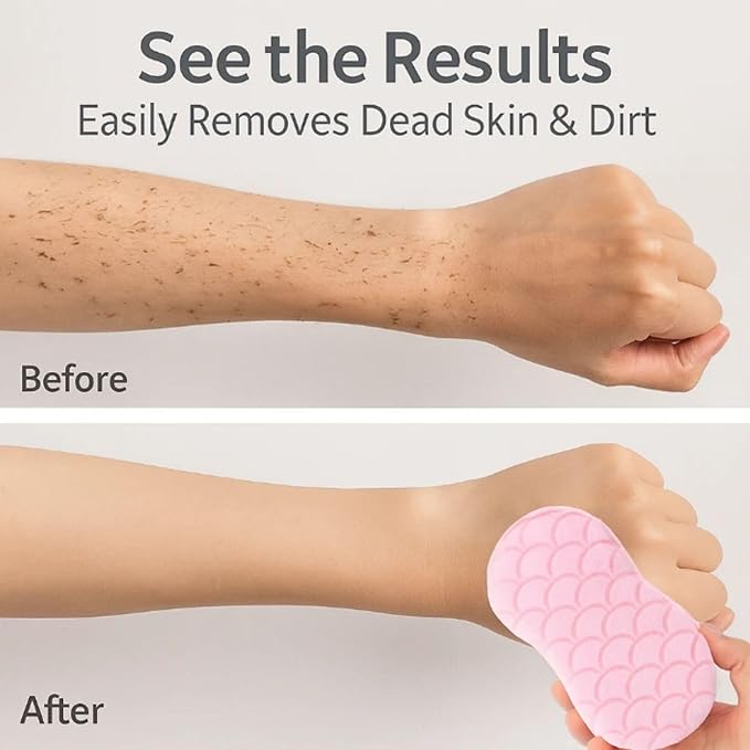 Skin Scrubber Exfoliator - 3D Super Soft Body Scrub Sponge for Dead Skin Removal, Reusable Skin-Friendly Exfoliator Also a Gentle Bath Sponge for Baby, for Adults, Kids & Pregnant Women (Blue+Pink)
