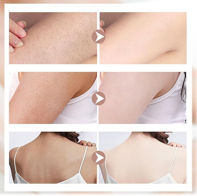 Super Soft Sunflower Suction Cup Bath Ball, ponge Mesh Pouf Shower Ball for Women, Men Shower,2024 Upgraded 2-in-1 Sunflower Bath Ball,Exfoliating Bath Sponge Cleaning Brush. (Purple+Yellow)