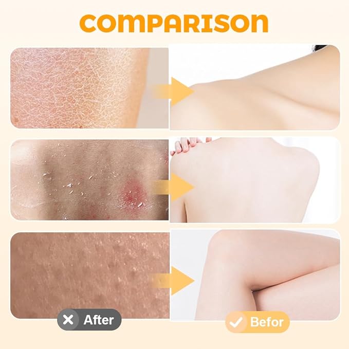 Super Soft Sunflower Suction Cup Bath Ball, 2025 New Exfoliating Bath Bath Sponge Cleaning Brush with Finger Rings for Women and Men (Blue, 4 pcs)