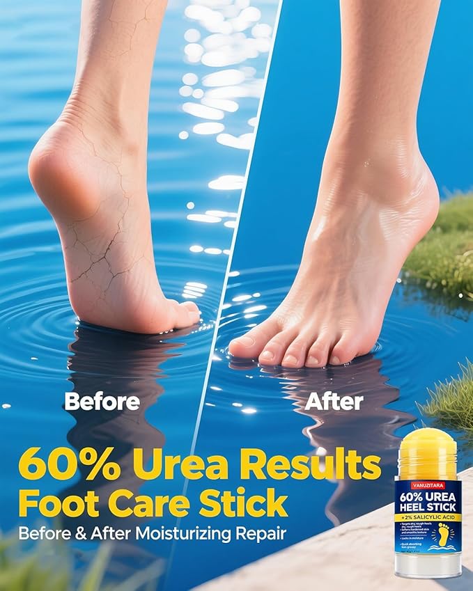Urea Cream 60% with 2% Salicylic Acid, Foot Cream 60 Percent for Feet & Hands, Maximum Strength Urea Stick for Rough, Dry Cracked Feet Hands Elbows, Callus Remover, Skin Softener Balm 1.41oz