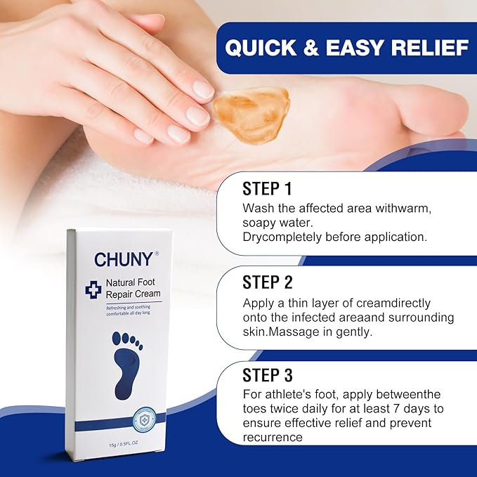 CHUNY Foot Cream for Cracked Heels Cream - Extra Strength for Cracked Heels, Dry Skin & Itchy Feet – Soothes Burning, Scaling & Irritation for Men and Women