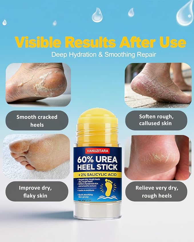 Urea Cream 60 Percent with 2% Salicylic Acid, Maximum Strength Foot Cream for Rough, Dry Cracked Feet Hands and Elbows, Urea Stick Callus Remover Skin Softener Hydrating Balm 2 Pack (1.41oz Each)