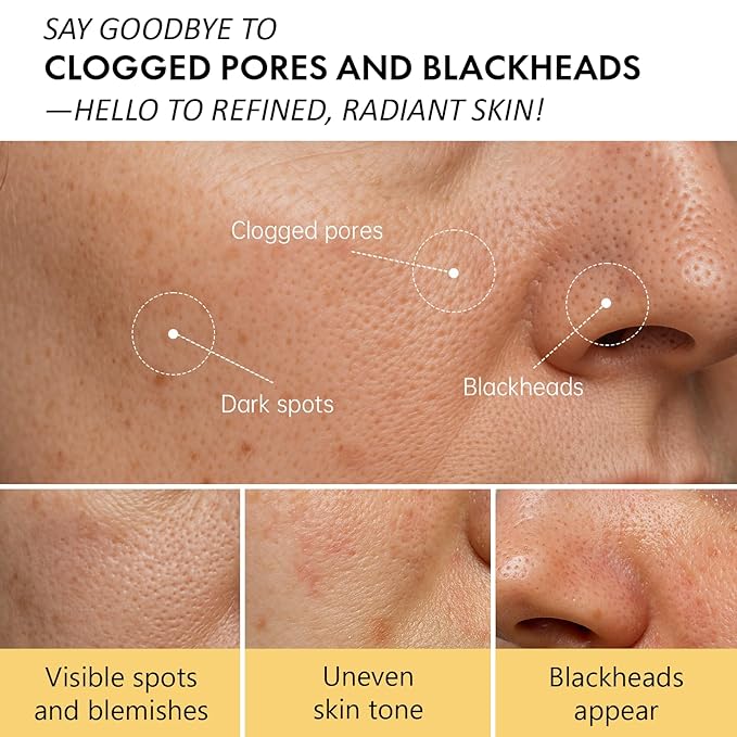 Warming Clay Facial Mask for Deep Pore Cleansing – Self-Heating Mud Mask for Face, Purifying & Pore-Refining Treatment, Helps Remove Blackheads, Improves Skin Texture, Spa-Like Care, 4.94Oz