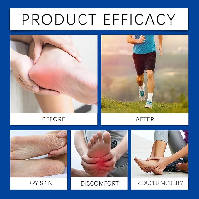 Plantar Fasciitis Cream (2.12OZ) - Spur Cream Soothes Stiffness and soreness, heel spurs & other foot discomfort , Natural Herbal Formula with Arnica & Menthol, Suitable for Sensitive Skin