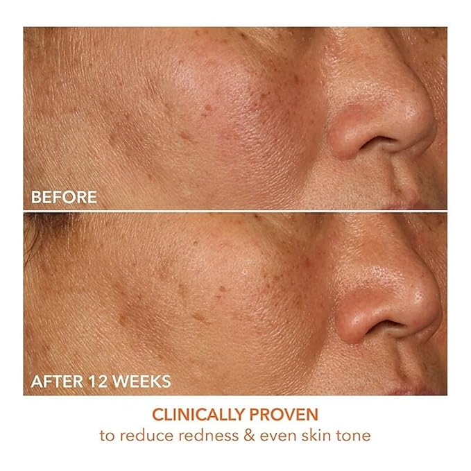 Dr Dennis Gross Vitamin C Lactic 15% Firm & Brighten Serum: Visibly Improve Signs of Aging, 1 oz