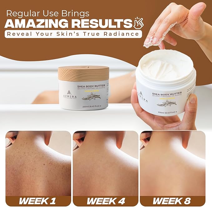AZMERA Handcrafted Whipped Shea Body Butter – Luxurious Vanilla Bean Scented Moisturizer for Dry, Sensitive Skin, Argan Oil & Vitamin E – Vegan, Non-Greasy Skincare – 8.82 oz