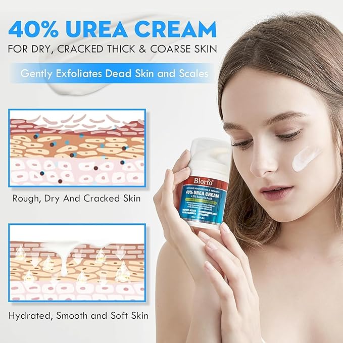 Urea Cream 40% Percent Foot Care Plus 2% Salicylic Acid 3.52 Fluid oz,Foot and Hand Cream Maximum Strength with Aloe Vera and Shea Butter,for calluses and Dry – 2-Pack