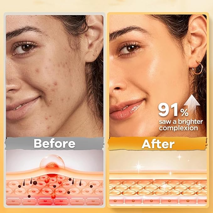 Veronia Orange Enzyme Exfoliating Gel, Moisturizer Face Body Scrub Gel, Deep Clean Pores, Remove Blackheads & Moisturize Skin, All Types Skin (1pcs)