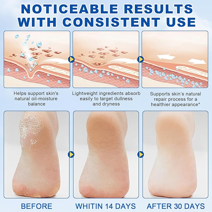 Urea Cream 60 Percent for Feet, Urea Foot Cream for Cracked Heels and Dry Skin, Cracked Heel Repair Cream Plus 2% Salicylic Acid, Foot Cream for Calluses and Hard Skin 1PCS