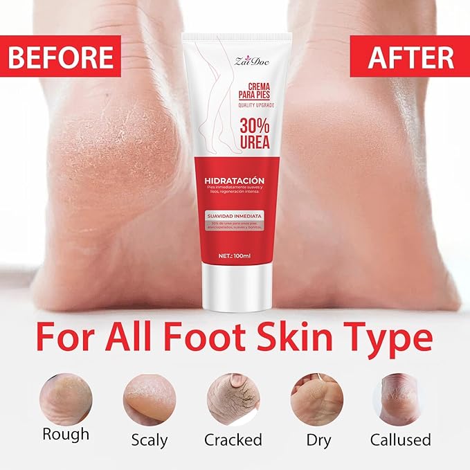 2 Pack Urea Cream 30 Percent for Feet 3.38 oz, Foot Cream and Hand Cream Maximum Strength with Hyaluronic Acid, Aloe Vera for Deep Moisturizes, Callus Remover