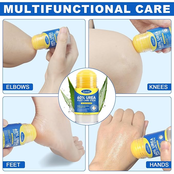 60% Urea Cream Stick with Salicylic Acid 2%, Urea Hydrating Foot Cream, Severe Cracked Heel Repair Restoring Balm, Foot Lotion Repairs and Hydrates Dry and Feet and Hand - 2 Packs