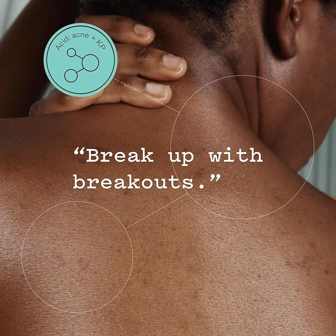 frank body Glycolic Acid Body Scrub | Fights KP & Breakouts, Spots & Tighten Pores | Reduces Acne with Niacinamide & Soothes with Witch Hazel | Glycolic Acid & Pumice | 8.82 oz | Pack of 1