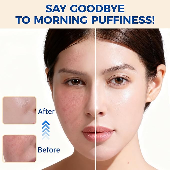 MORGLES Ice Roller for Face, Professional Face Roller Cryotherapy Tool to Reduce Puffiness, Redness & Headaches, Tighten Skin and Improve Lymphatic Drainage with Ergonomic Handle (Pink)