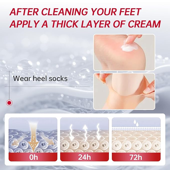 Urea Cream 40 Percent for Feet Maximum Strength, with Heel Protectors, Foot Moisturizer Cream for Dry Cracked Heels Rough Dead Dry Skin Foot Callus Remover - 5.29 Oz