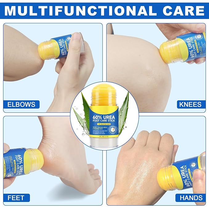 60% Urea with 2% Salicylic Acid Foot Care Stick, Urea Foot Cream Moisturizer for Dry Cracked Feet, Knees, Elbows, Hands, Moisturizes and Hydrates the Dry Skin 1Pack