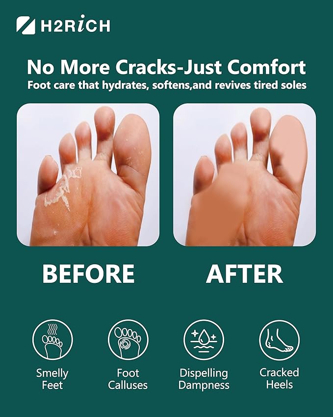 Hydrogen Foot Soak Effervescent Tablets 3 Pack | Ginger & Mugwort Herb Foot Bath, Relaxing Spa Pedicure Care | Improves Circulation, Soothes Tired Feet, Softens Calluses, Controls Odor