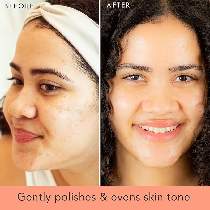 Face Scrub and Face Wash, Gentle Exfoliating, Cleansing Facial Scrub Exfoliator, Natural & Organic Ingredients