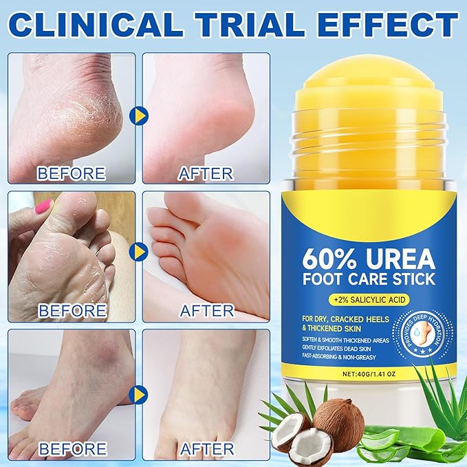 Urea Foot Cream, Urea Cream 60 Percent for Feet, Foot Cream for Cracked Heels and Dry Skin, Cracked Heel Repair Cream Plus 2% Salicylic Acid, for Calluses and Hard Skin 2PCS
