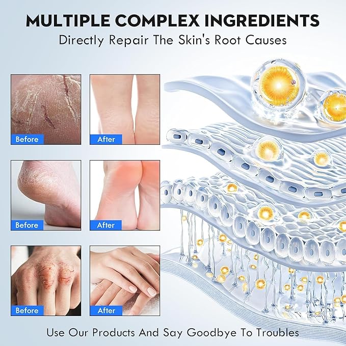 Urea Cream 40% Percent Foot Care Plus 2% Salicylic Acid 3.52 Fluid oz,Foot and Hand Cream Maximum Strength with Aloe Vera and Shea Butter,for calluses and Dry – 2-Pack