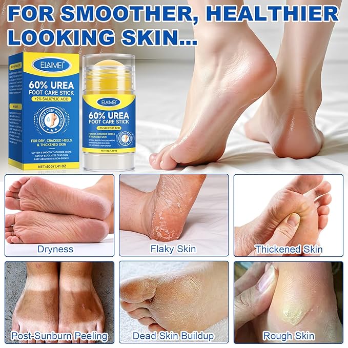 60% Urea Cream Stick with Salicylic Acid 2%, Urea Hydrating Foot Cream, Severe Cracked Heel Repair Restoring Balm, Foot Lotion Repairs and Hydrates Dry and Feet and Hand